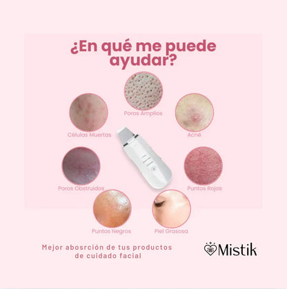 Limpiador Ultrasónico MultiPeel Power